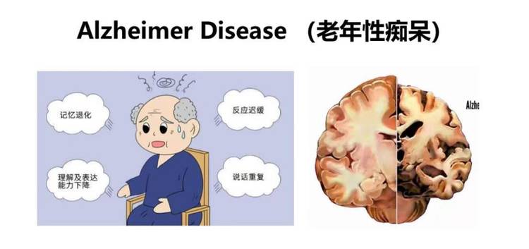 迪安诊断晓飞检与环球细胞库达成老年痴呆防治战略合作