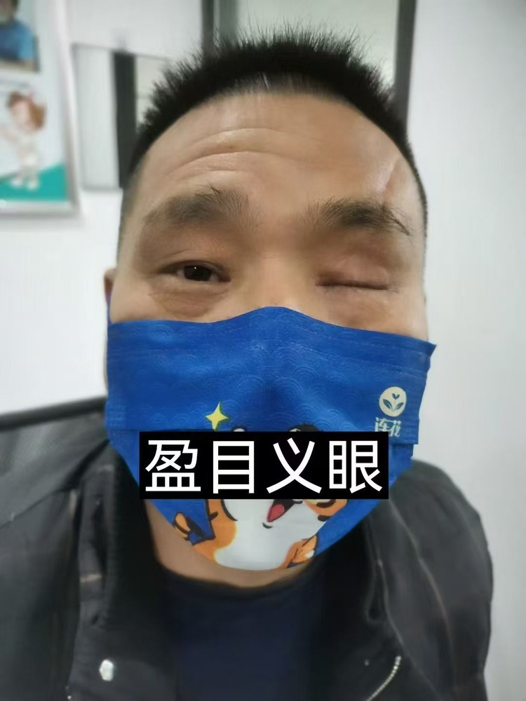 湘潭定制高分子义眼片选什么靠谱机构，团队实力测评